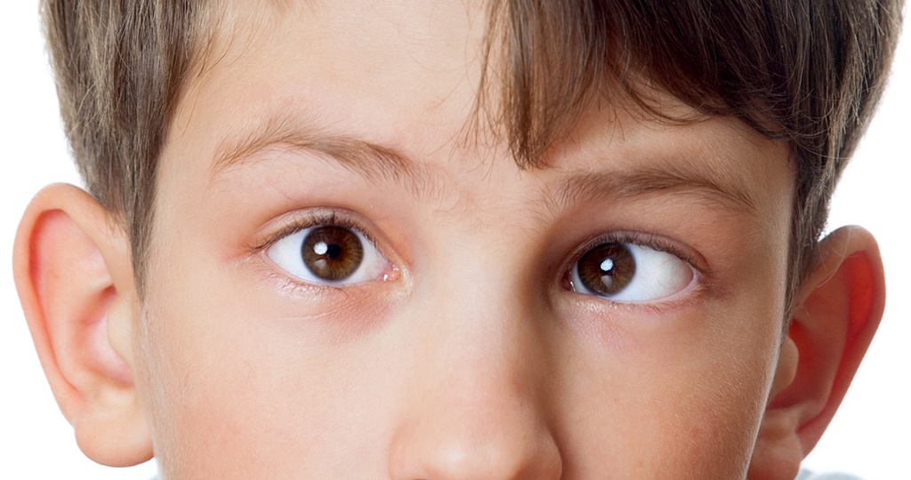 Синдром ленивого глаза-Амблиопия